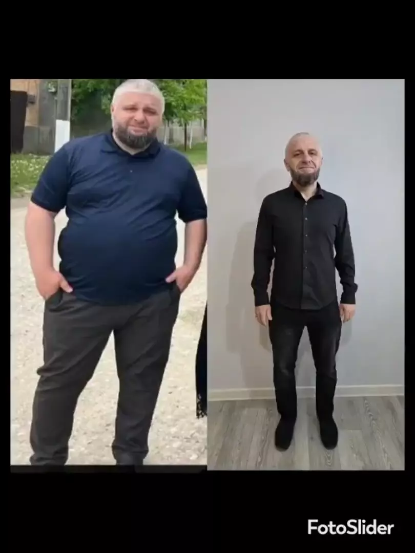 Услуги диетолога: сбросить вес без голоданий, убрать бока и живот, улучшить рельеф мышц